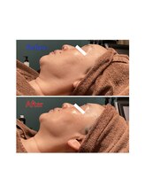 サロン ド メタセコイア(salon de Metasequoia)/フェイシャル