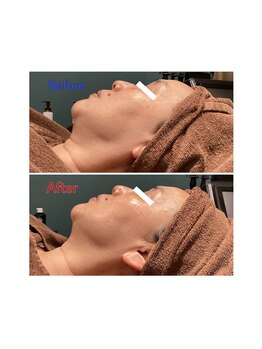 サロン ド メタセコイア(salon de Metasequoia)/フェイシャル