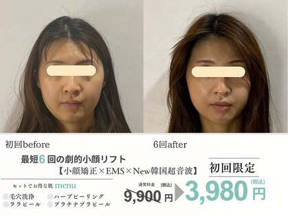 エスポワール(espoir)の写真
