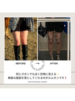 ヨサパーク カリーナ(YOSA PARK carina)/オーナーbefore/after
