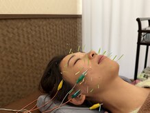 チャチャエイム整骨院 鍼灸院/美容鍼でリフレッシュ