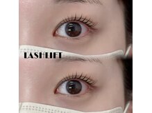 ジッピーオブヘア アイエク(Zippy of hair iEQ)