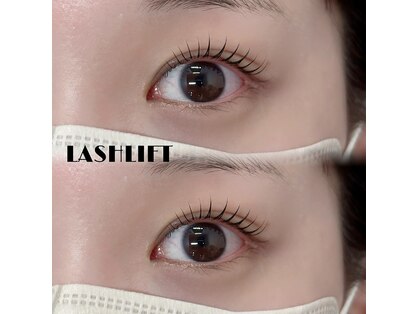 ジッピーオブヘア アイエク(Zippy of hair iEQ)の写真