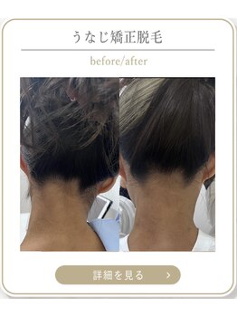 ミース 上野店/上野で美うなじ体験♪