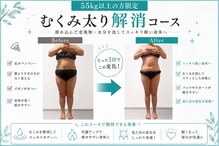 バーレ(BARRE)