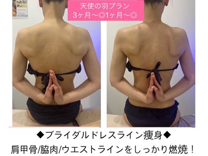 リンダ(Rinda)の写真