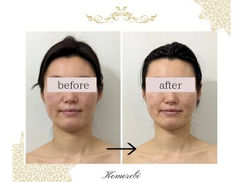 コモレビ(Komorebi)/