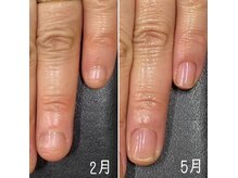 ネイルズ アヴァンティ(Nails Avanti)の雰囲気（深爪、丸爪をケアで縦長爪に育成♪最強のネイルケア3ヶ月コース）