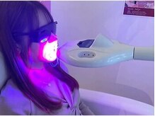 エクシアホワイトニング エミフルMASAKI店/6 照射(1回9分)