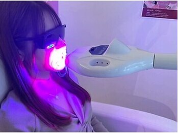 エクシアホワイトニング エミフルMASAKI店/6 照射(1回9分)