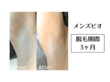 メンズビオ 神戸三宮店/