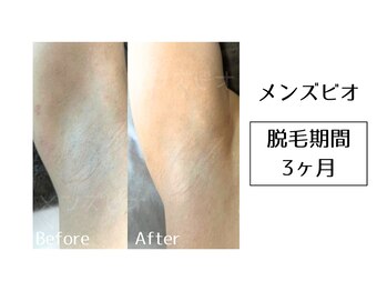 メンズビオ 神戸三宮店/