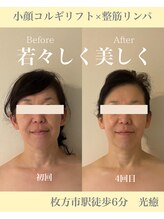 光癒(コウユ)/Before.After
