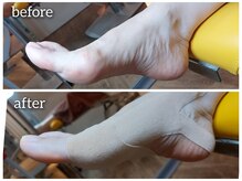 爪切り屋 足楽/【足のアーチ】サポートします