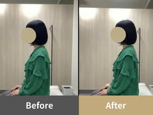 クオーレ(Cuore)/Before After