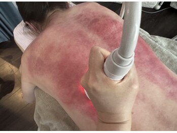 メディカル整体院/スライドカッピング