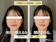 ソルビーフェイス(SOL*BeFace)の写真