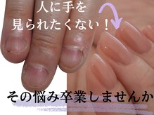 アメジスト(Amethyst)