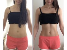 骨盤ストレッチ整体 b/矯正＋EMS