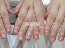 ミンスネイル(Mins Nail)/深爪長さ出しbefore&after