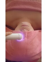 スリムモネ(Slimmone)/眼精疲労や目元ケアにグロッティ