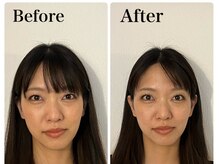 ピオニー(Peony)/Before & After