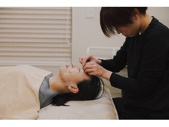 フュー(few.)/女性鍼灸師が施術を行います！