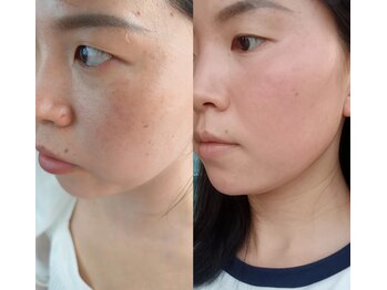 ユミサロン(U Mi Salon)/