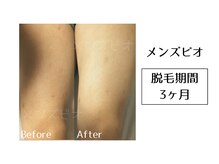 メンズビオ 神戸三宮店/