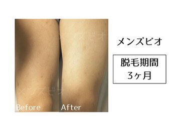 メンズビオ 神戸三宮店/