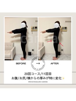 ヨサパーク カリーナ(YOSA PARK carina)/【途中経過】20回コース/11回目