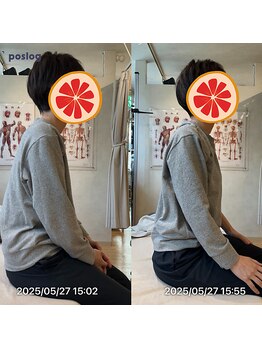 グレフル鍼灸接骨院 整体院 心斎橋/整体/肩こり/マッサージ/腰痛