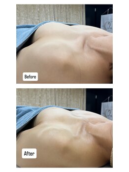 チュラ 大宮店(Chura)/【40代】ふわッとバストアップ♪