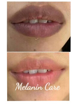 ペキュリア 恵比寿店(PEQLIA)/最新の黒ずみケアで唇ケア♪