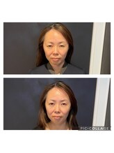 友愛はりきゅう美容整体院/ELコスメティック美容鍼