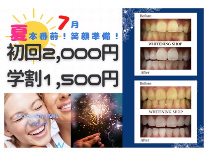 ホワイトニングショップ 川越店の写真
