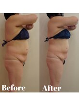 トータルビューティサロン クイーン(Queen)/たるみケアもお任せ下さい！