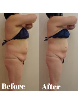 トータルビューティサロン クイーン(Queen)/たるみケアもお任せ下さい!