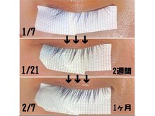 ベッロ(Bello)/エグータム美容液取扱店