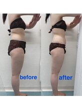 ハロ 南青山(HALO)/月額通い放題1ヶ月のお写真