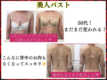 ニコ 岐南本店(Nico)/バスト★before→after