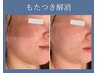 たるみ改善【大人たるみ肌引締め】光美顔フォト+デコルテ・フット・ヘッド付
