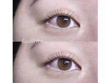 フィールリファイン(Feel Refine)/ラッシュリフト