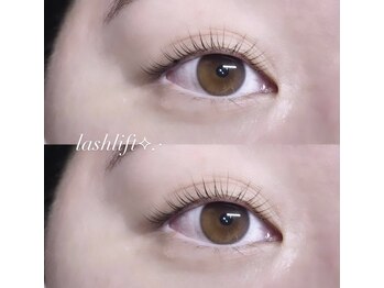 フィールリファイン(Feel Refine)/ラッシュリフト