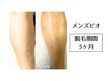 メンズビオ 神戸三宮店/