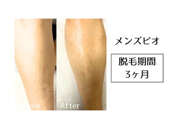 メンズビオ 神戸三宮店/