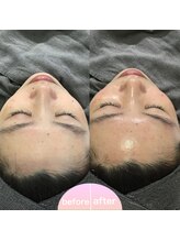 ミュー 植田店(mieux)/◆ビフォーアフター