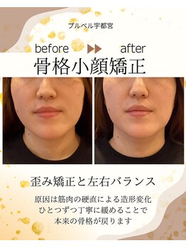 プルベル 宇都宮店(Plus Belle)/小顔矯正/たるみ改善/しわ改善