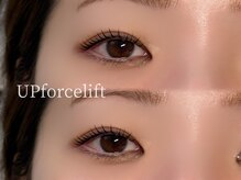 ジュベアイラッシュ 別府店(juve. eyelash)/UPforcelift
