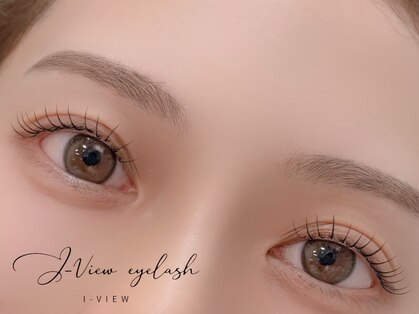 アイビュー(I-VIEW)の写真
